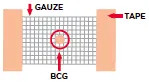 BCG Vaccine: After Care for Parents – English version - HE2226