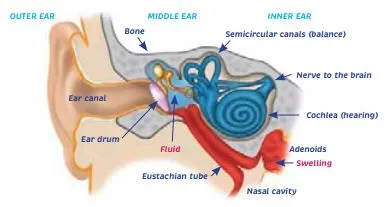 Ear infections, earache and glue ear - HE1414