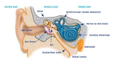 Ear infections, earache and glue ear - HE1414