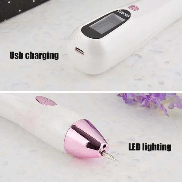 Laser Tattoo Removal