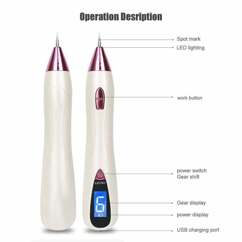 Laser Tattoo Removal