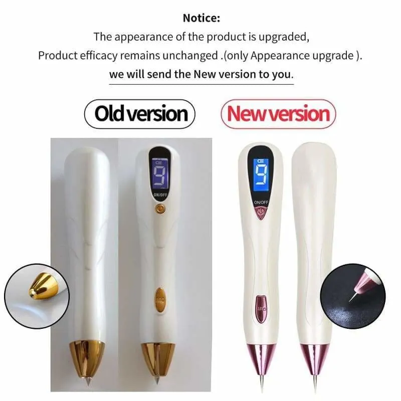 Laser Tattoo Removal